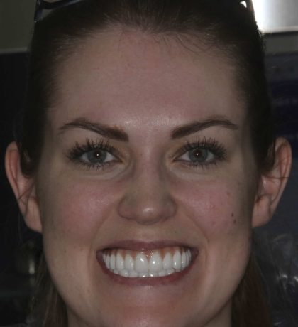 Boise Prosthodontics 208.376.0567