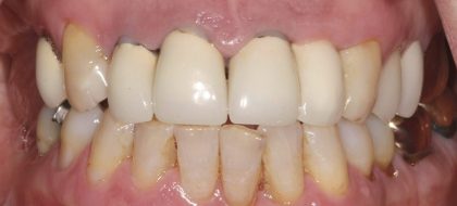 Close up of teeth