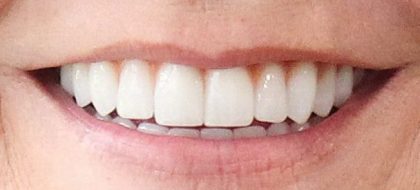 Close up of teeth