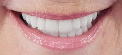 Close up of teeth