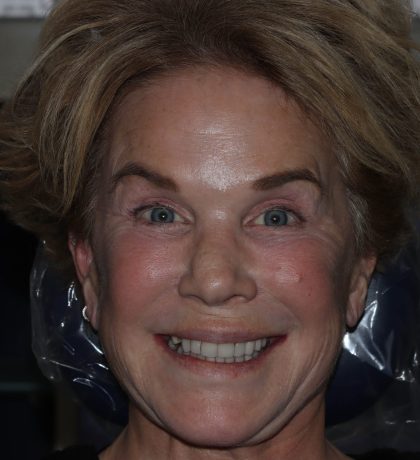Close up of person smiling