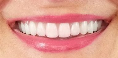 Close up of teeth