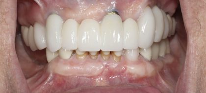 Close up of teeth