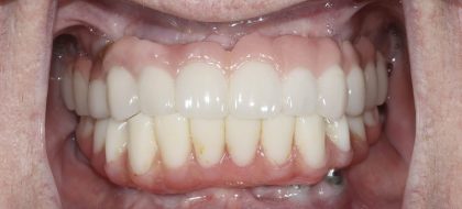 Close up of teeth