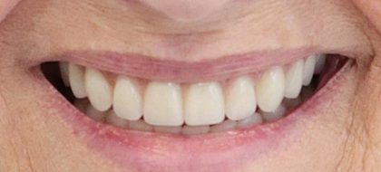 Close up of teeth