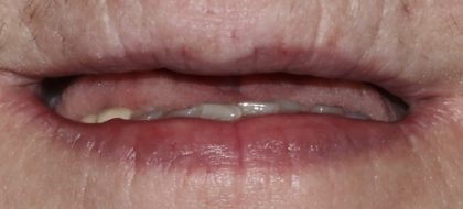 Close up of teeth