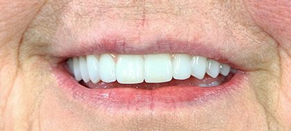 Close up of teeth