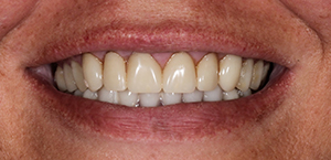 Close up of teeth