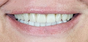 Close up of teeth