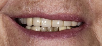 Close up of teeth