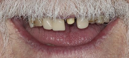 Close up of teeth