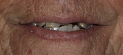 Close up of teeth