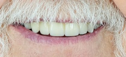Close up of teeth