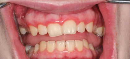 Close up of teeth