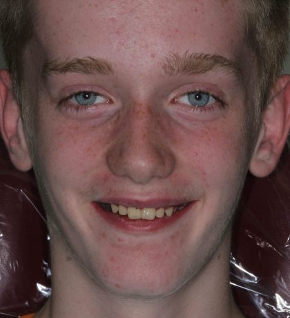 Close up of person smiling