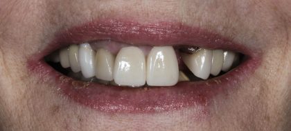 Close up of teeth