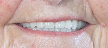 Close up of teeth