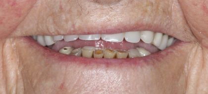 Close up of teeth