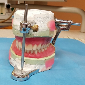 prosthodontist boise teeth in a day implant-supported dentures